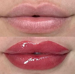 Micropigmentação Labial + Hydra Lips