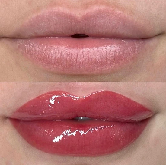 Micropigmentação Labial + Hydra Lips